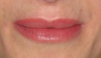 Primer pla de llavis naturals amb color suau rosat, resultat de micropigmentació labial